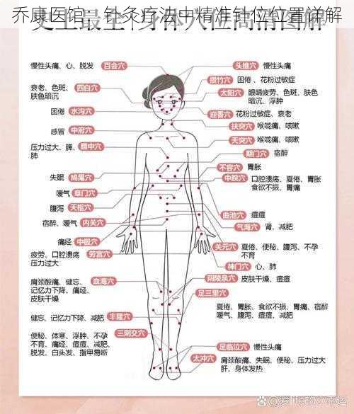 乔康医馆：针灸疗法中精准针位位置详解